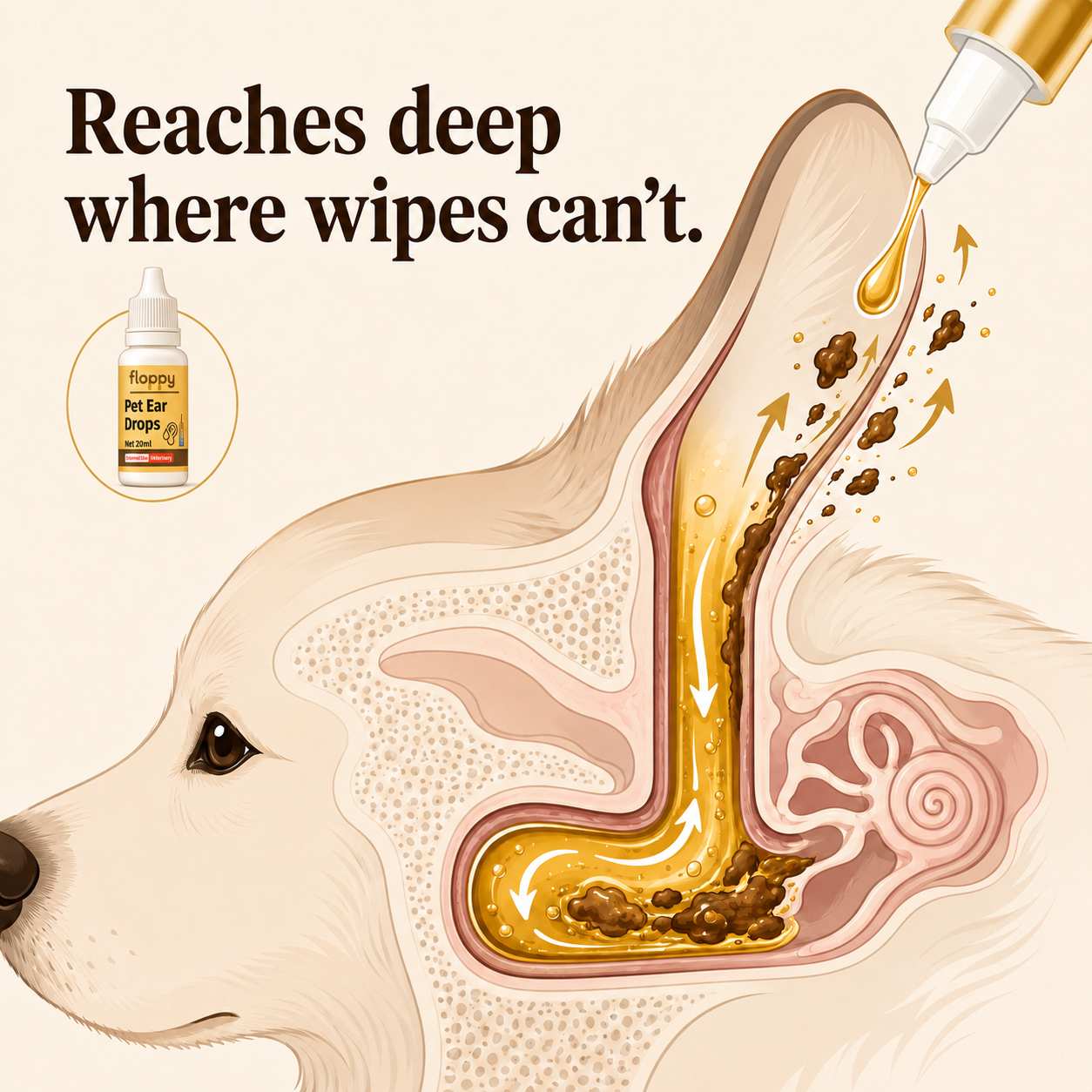 Deep-Root Flush diagram showing the liquid reaching the deep bend of the L-shaped ear canal